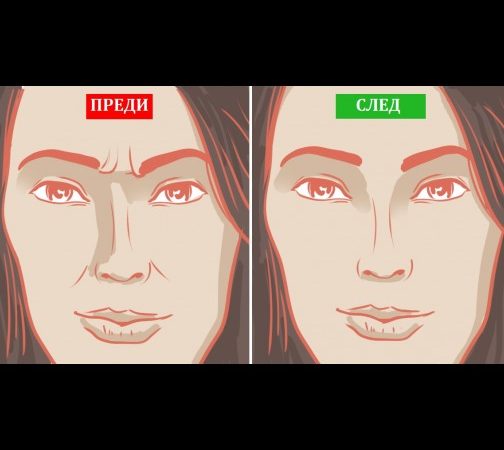 Как да се отървем от бръчките, без да използваме ботокс, филъри и скъпа козметика? img
