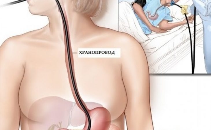 Всички имаме достъп до него целогодишно, а не знаем, че предпазва от рак на стомаха! img