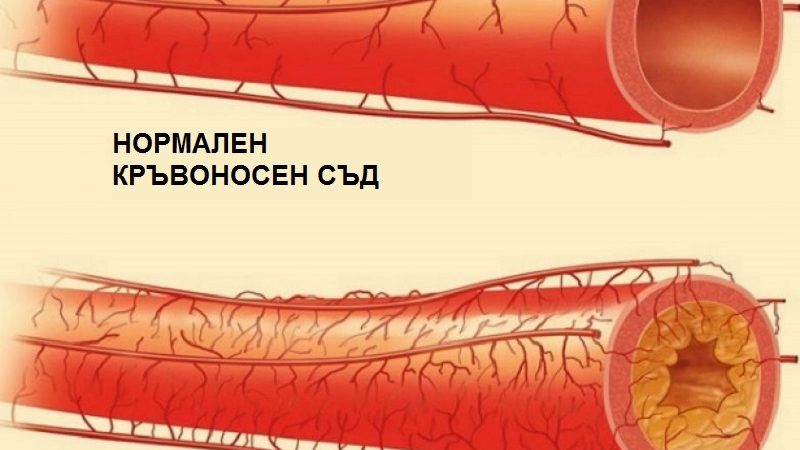 Малко е неприятно на вкус, но пък чисти мощно кръвоносните съдове и ме пази от инсулт! img