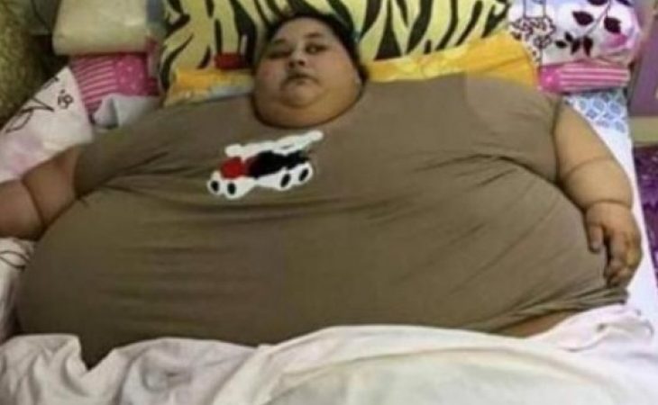 500 килограмова жена ляга под ножа за операция за отслабване img