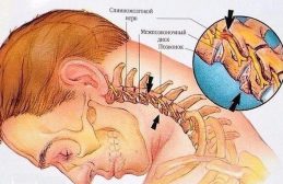 Излекувайте мигрената, болките в гърба и световъртежа с няколко прости упражнения! img