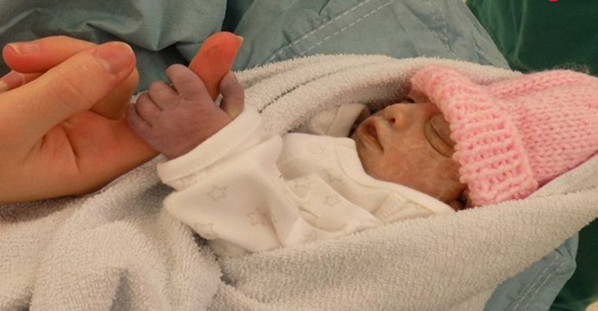 Вижте историята на малката Хоуп, която живя само 74 минути, но направи повече, отколкото някои хора за цял живот! img
