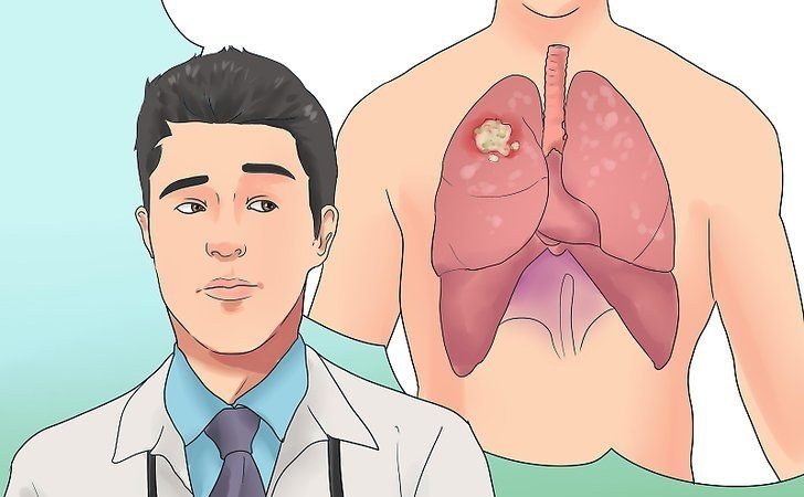 Учени от Харвард разкриха кои храни причиняват рак – вижте черния списък! img