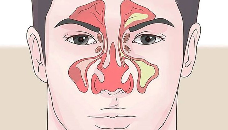 как да си отпушим носа