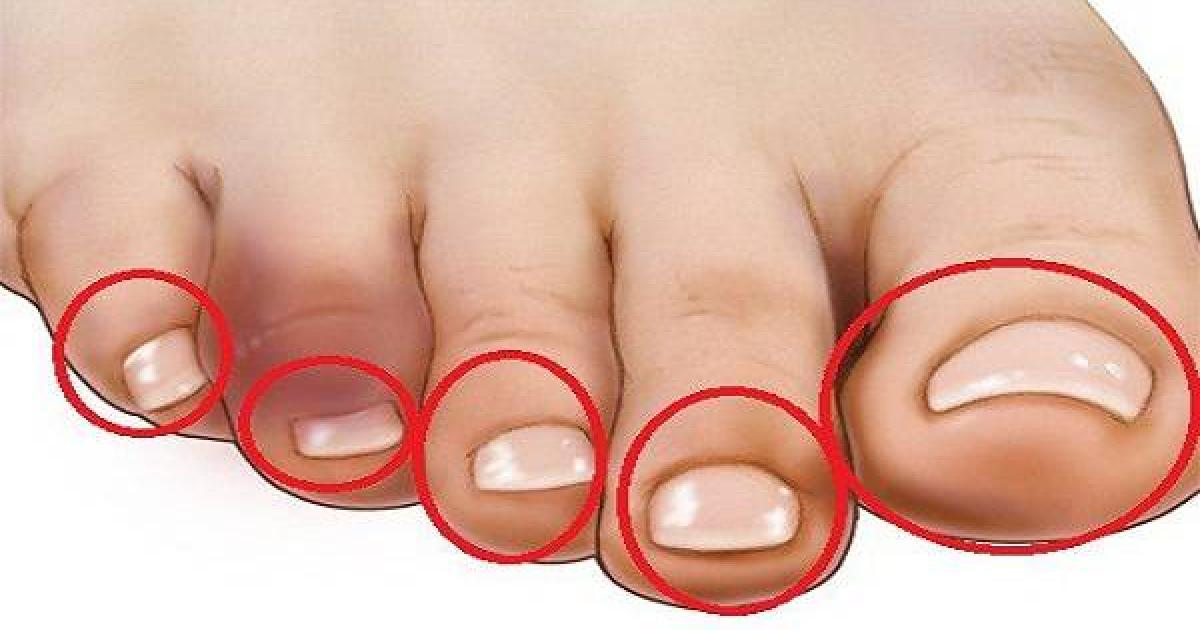 пръсти на краката
