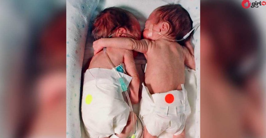 Чудото на живота! Новородено бебенце издъхваше, но сложиха близначката му до него и тогава… img