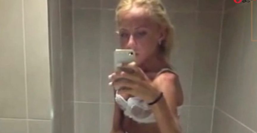 Тя тежала 25 кг. и всички лекари я отписвали, но след 2 години няма да повярвате как изглежда ( снимки) img