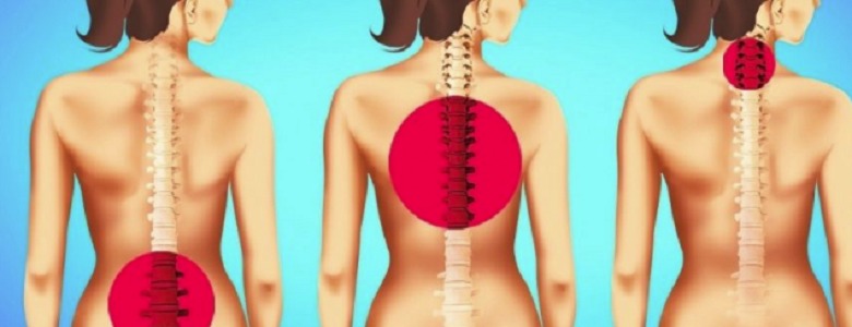 Едноминутни стречинг упражнения за намаляване на болките в гърба